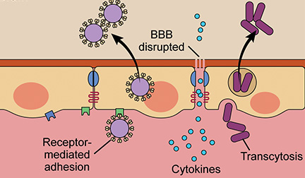 Visualizing CNS Infections: A Recent Collaboration